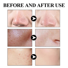 Blackhead Removal Solid Mud Mask Oil Control Pore