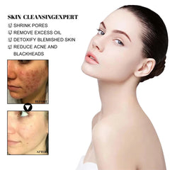 Blackhead Removal Solid Mud Mask Oil Control Pore